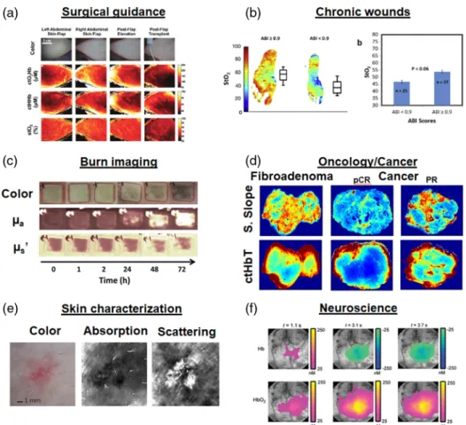 Fig. 10 Example of in vivo applications of SFDI: (a) surgical guidance with the imaging of flap transplants oxygenation and chromophore concentration adapted from Ref