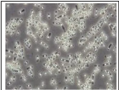 Figure  9 : Observation microscopique de cellules sporulées de Bacillus cereus                   (Anses, 2011).