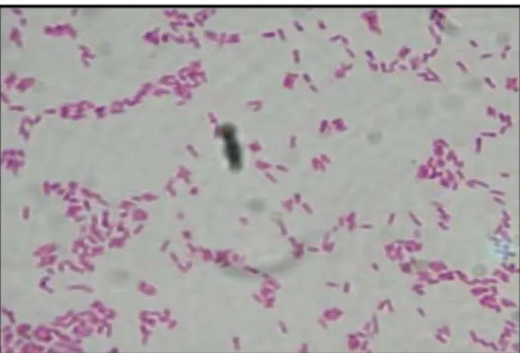 Figure 15:Coloration de Gram et l'Observation microscopique (Grossissement X100) des  souches isolées d'E.coli