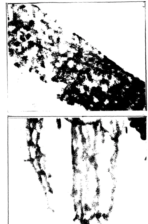 Figure  5.3  Photographs  of AtT-20  detaching  from smooth  (A) and  grooved  substrata  (B).