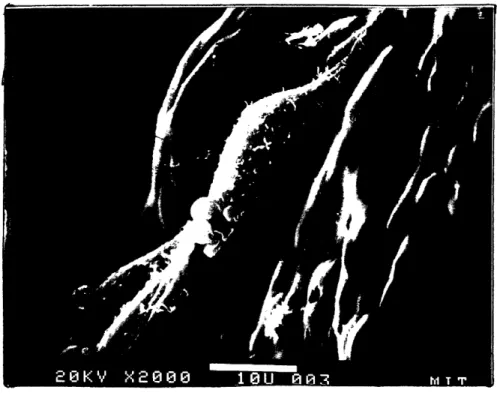 Figure  1.2.  A.)  AtT-20  cells  attached  on  a  relatively  smooth  area  of  a  MgO.AI 2 0 3