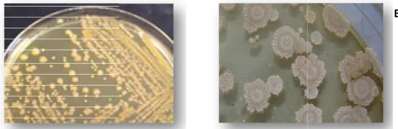 Figure 12: Observation macroscopique de la souche de la souche