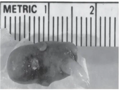 Figure  8 :  Embryon  cylindrique  d’une  FCS  à  la  9 ème     semaine  de  gestation