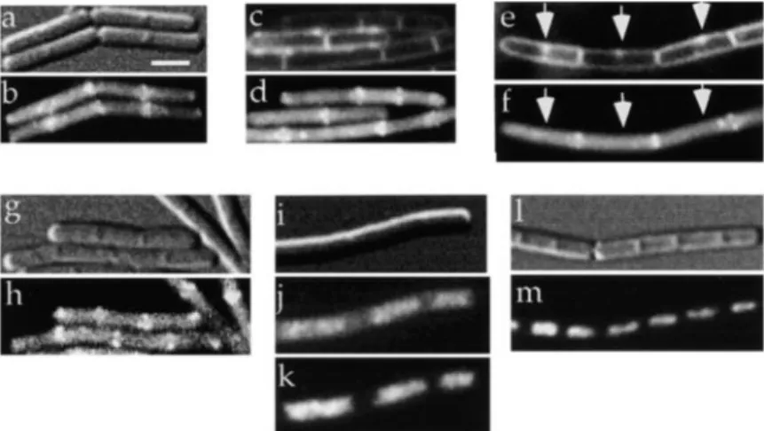 Figure 2. Subcellular Localization of Soj as Visualized with Fusions to GFP