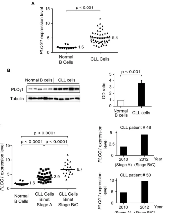 Fig 5. PLC γ 1 is over-expressed in CLL cells. (A) PLCG1 mRNA levels were determined in normal ( n = 11) and CLL ( n = 50) B cells