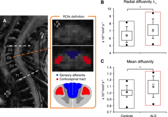 Figure 2 shows the mean PT and MT for median and ulnar nerves in controls and patients