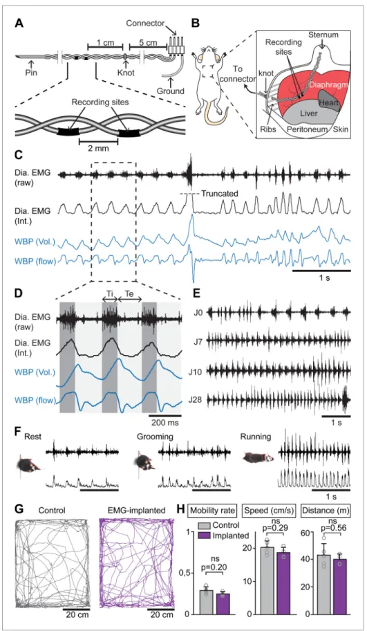 Figure 1. Chronic electromyographic recordings of the diaphragm to monitor inspiration in freely moving mice.