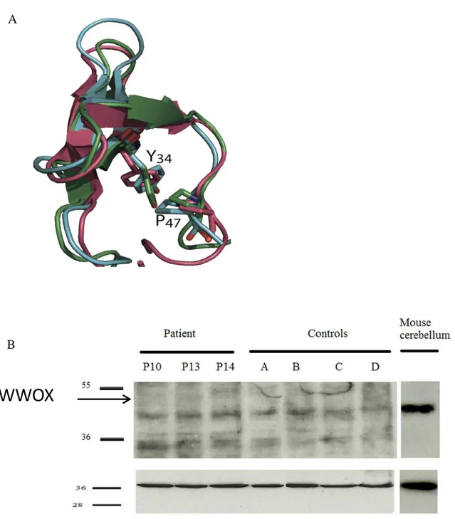 Figure 2: Analysis of normal and p.Pro47Thr mutant WWOX protein 