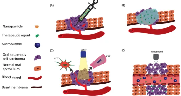 Figure 2. Different controlled drug delivery approaches: (A) Intra-tumoral drug delivery; (B) local  drug delivery; (C) photo-thermal therapies combined to drug delivery systems; (D)  ultrasound-mediated microbubble