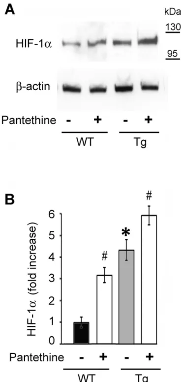 Fig 6. HIF-1α protein levels in Tg and WT astrocytes. (A) Western blot analysis of HIF-1α expression in astrocytes treated or not with pantethine
