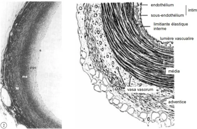 Figure 1. À gauche, coupe d'artère coronaire issue d'un enfant de 16 mois, fixée à pression physiologique  et vue par microscopie optique (Stary et al