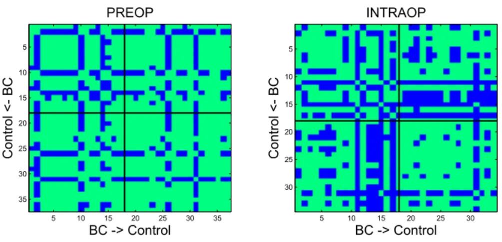 Figure 3: Correlation matrix of PREOP (left) and INTRAOP (right) spectra: correlation coefficients &gt; 0.95 are set to 1 (green), 0 otherwise (blue).