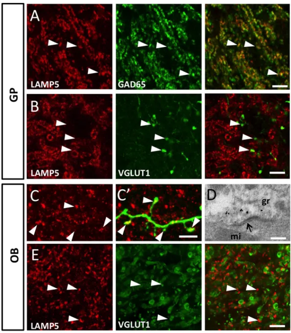 Fig 3. LAMP5 is specifically expressed in GABAergic synapses. (A) Immunofluorescence labeling for LAMP5 and GAD65 proteins demonstrates co-labelling in GABAergic axon terminals in the GP (arrowheads)