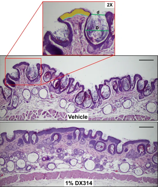 Figure 5: DX314 reduces rhino mouse skin abnormalities. Representative HE staining of skin biopsies  from rhino mice topically treated for 11 days with vehicle (acetone) or 1% DX314