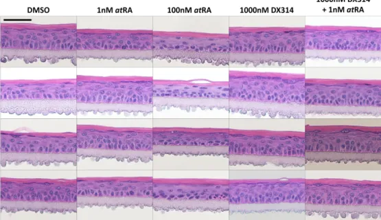 Figure S3: Tissues used in semi-quantitative analysis of relative stratum granulosum (SG)  surface area