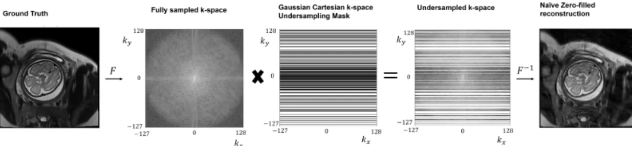 Figure 2-2: In retrospective undersampling, the fully sampled k-space of the original image is undersampled by elementwise multiplication with a k-space undersampling mask