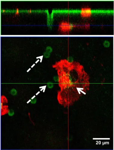 Figure  S16.  Orthogonal  view  of  z-stack  confocal  micrographs.  Single  MDM  after  clearing  the particles on the apical side move and translocate to basal side (bottom)