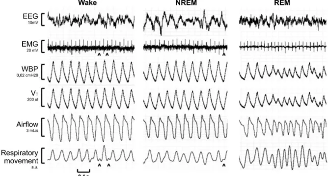 Figure 6: Recording sections of a WBP full polysomnographic study demonstrating respiratory  waveforms during quiet wakefulness (left), non-rapid eye movement (NREM) sleep (middle),  and rapid eye movement (REM) sleep (right) in one mouse