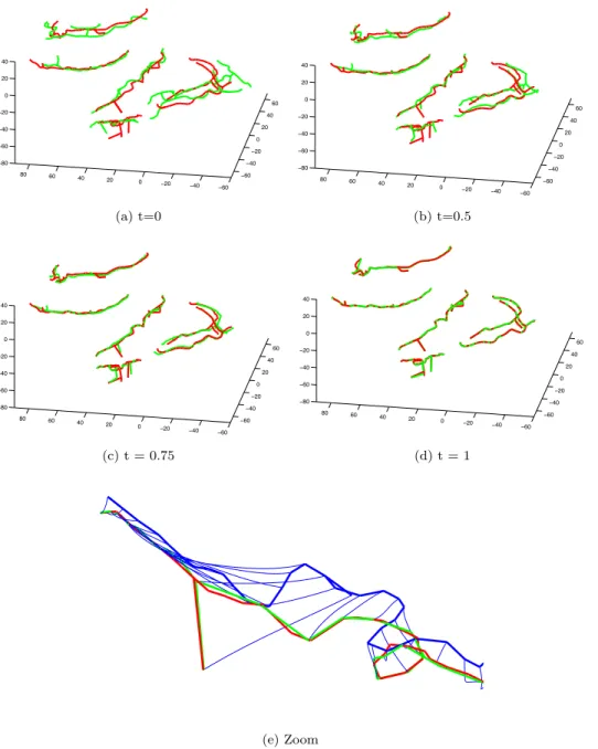 Fig. 5. Registration of brain sulci of two subjects with normal cycles. σ V = 10 and σ W = 7.