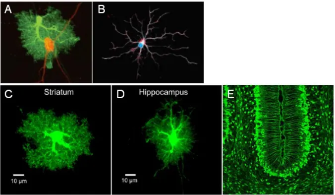 Figure 3: Example of different types of astrocytes.  