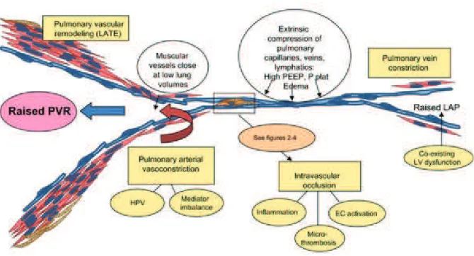 Figure  10:  La  dysfonction  vasculaire  pulmonaire  au  cours  de  l'ARDS  r•sultent  de  m•canismes  d'occlusion  microvasculaire, d'hyperperm•abilit• et …d€me interstitiel, d•s•quilibre de la balance des m•diateurs vasoactifs,  compression  extrins€que