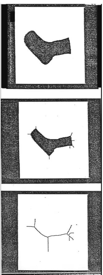 Figure 18 : Amincissement et squelette d’un objet
