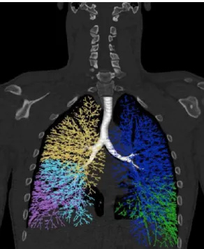 Figure  5:  Space-filling  tracheo-bronchial  tree  representation  on  a  human  lung