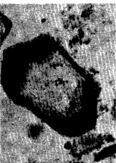 Fig. 2 and 3 ｮ･ｨｹｾｲ｡ｴｩｯｮ of raw gypsum b-axis: c-axis: a-axis: No dehydration;