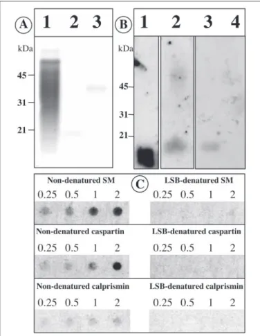 FIGURE 4. N-terminal sequence of calprismin, the 38-kDa protein of the acetic acid-soluble prism matrix