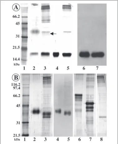 FIGURE 7. Chemical deglycosylation study with TFMS acid at 0 °C. Analysis of the samples on silver-stained gel (12% acrylamide (A)) and on Western blot (12% acrylamide (B))