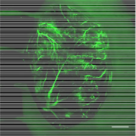 Figure 11. Ex vivo cartography of cardiac blood vasculature. Intravenous injection of fluorescein  isothiocyanate (FITC)-dextran was performed in anaesthetized animals (for experimental  procedures, please see [183])