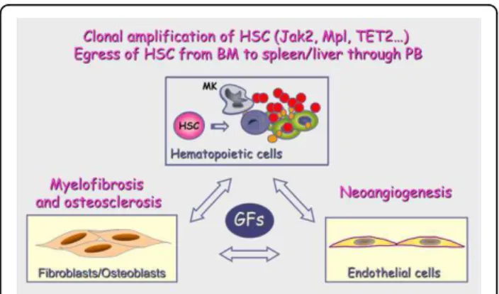 Figure 1 Pathophysiological characteristics of PMF. Primary myelofibrosis is characterized by a clonal amplification of