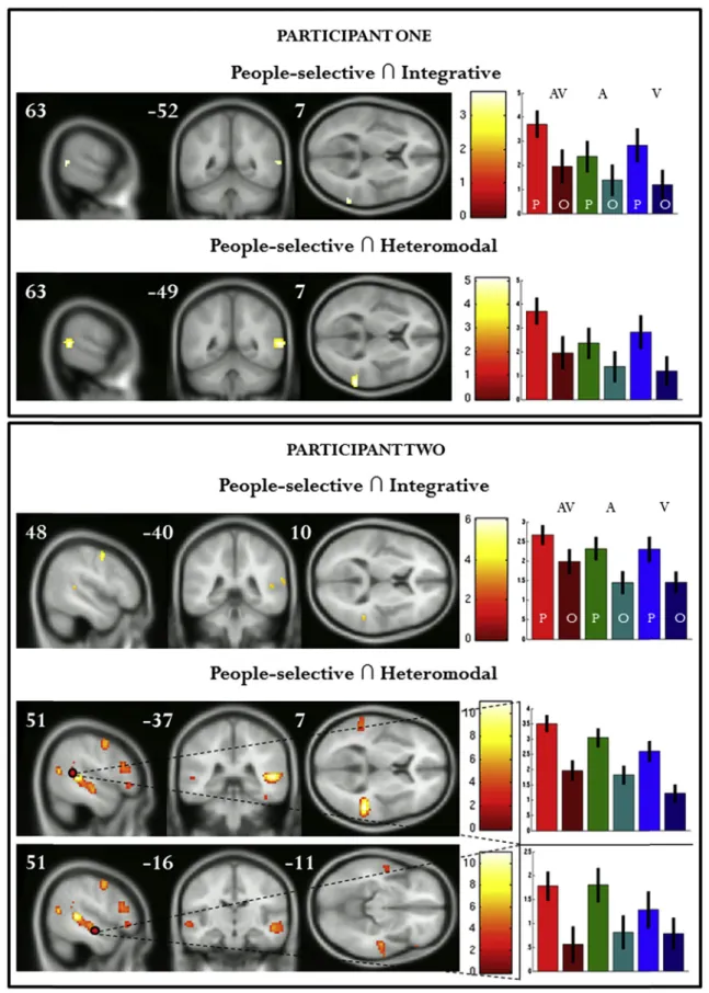 Fig. 3 e Results from individual participants: people-selective, integrative regions and people-selective, heteromodal regions