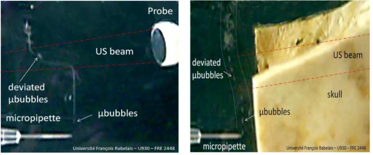 Fig. 7. In vitro experiment (embedding medium: water). Trajectory of bubble flow deviated by the US beam (2MHz)
