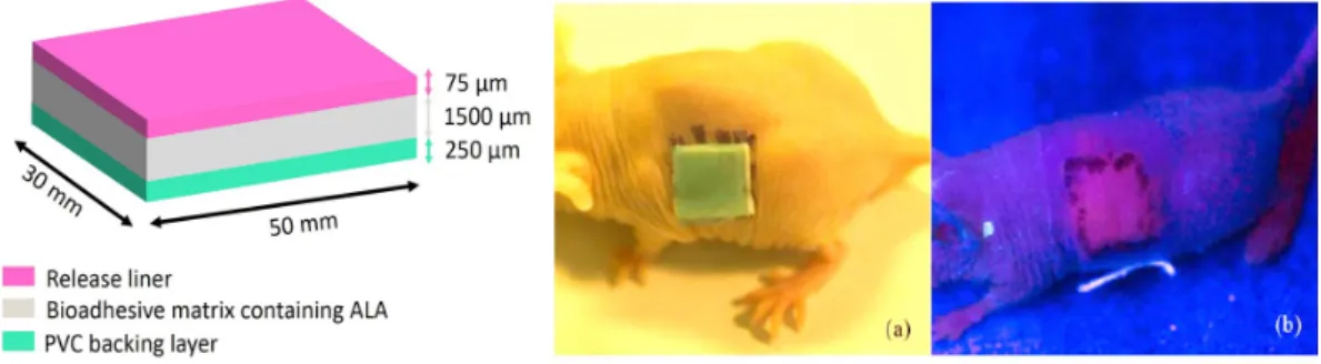 Figure 5: Patch formulation and its in vivo use on nude mouse. PpIX fluorescence was observed 4 h after patch removal [53].