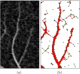 Figure 2.12: Non-local adjacency relation for the directed connected component filtering of blood vessels in retinal images
