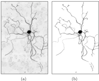 Figure 2.13: (a) Neurite image and (b) Directed connected filtering.
