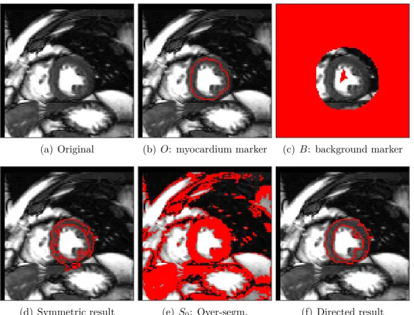 Figure 2.14: Marker based segmentation of the myocardium in MRI. (a) Original image. (b) and (c) The object and background markers