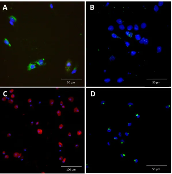 Figure 2. Immunofluorescence staining for interleukin-6 in liver sinusoidal endothelial cells and  Kupffer cells