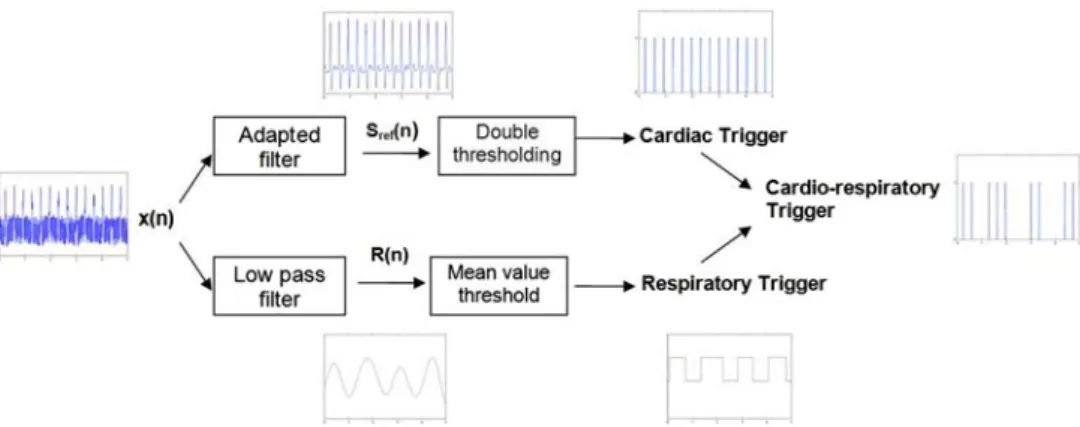 FIGURE 2. Real time cardiac-respiratory trigger extraction. The signal is subjected to an adapted filtering to enable QRS detection, as well as a low pass filtering to extract the respiration signal