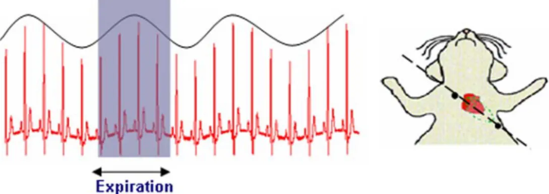 FIGURE 4. Respiratory modulation of the ECG signal. The respiratory dependent modulation of the ECG signal is maximized by placing the electrodes along the heart axis