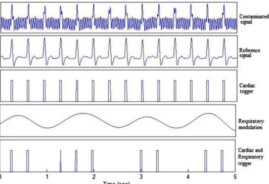 FIGURE 7. Synchronization signal extraction. Cardiac-respiratory trigger extraction from a mouse ECG recorded during the FSE sequence