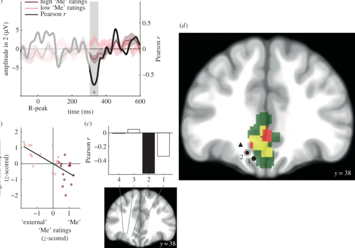 Figure 3. The trial-by-trial amplitude of HERs in the vmPFC correlates with the involvement of the ‘Me’ in spontaneous thoughts ( patient 1)