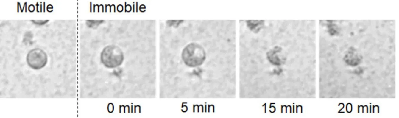Figure S1 Time lapse images of the immobilization and degradation of a zoospore exposed  to R32 in a bacterial suspension