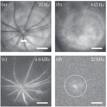 FIG. 3: Doppler fundus images at four frequency detunings