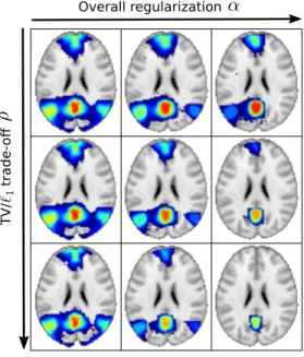 Figure 3.6: Effect of the variation of TV-MSDL regularization  pa-rameters α and ρ on the default mode network extraction