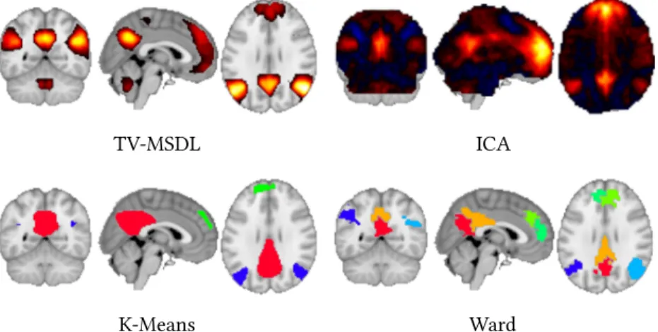 Figure 3.9: Default mode network extracted by different atlas  extrac-tion methods.