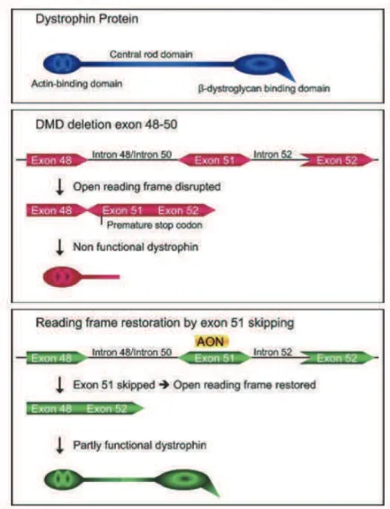 Figure  11 :  Approche  de  saut  dÕexon  dans  le  cadre  de  la  Dystrophie  Musculaire  de  Duchenne  (DMD)(d'apr•s Aartsma-Rus et Van Ommen 2007)