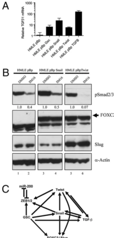 Fig. 1. Expression of EMT marker genes in breast cancer cell lines and nontransformed EMT-induced human mammary epithelial cells
