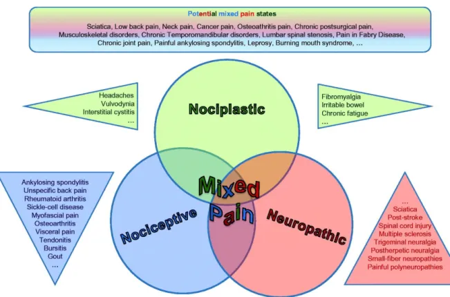 Figure 10 : Representation of “mixed pain” defined as the overlapping of the nociplastic, nociceptive and neuropathic pain  (Freynhagen et al., 2019) 